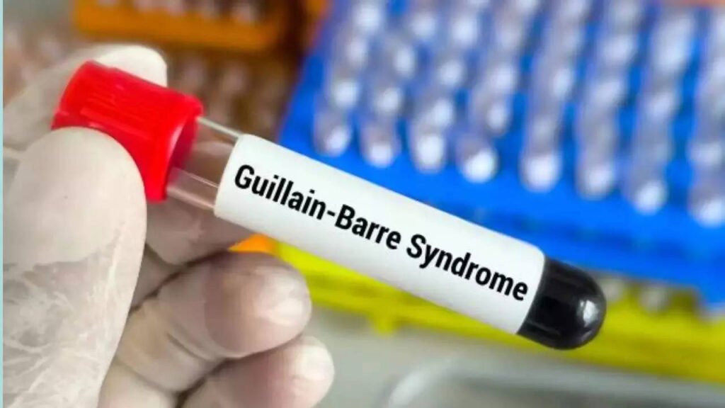 GBS Cases in Maharashtra Rise to 163, Five More Detected in Pune