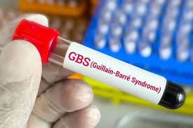 167 Guillain-Barre Syndrome Cases Detected In Maharashtra, 7 Deaths Reported